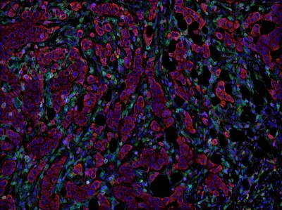 Multiplex immunohistochemistry - Anti-FOXP3 antibody [236A/E7] - BSA and Azide free (AB96048)