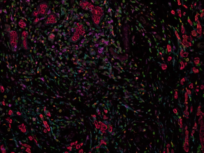 Multiplex immunohistochemistry - Anti-FOXP3 antibody [236A/E7] - BSA and Azide free (AB96048)