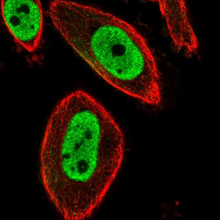 Immunocytochemistry/ Immunofluorescence - Anti-FOXP3 Antibody (AB327229)