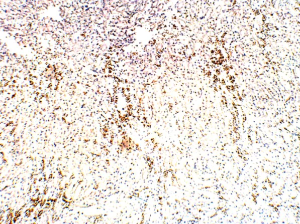 Immunohistochemistry (Formalin/PFA-fixed paraffin-embedded sections) - Anti-FOXP3 antibody (AB75763)