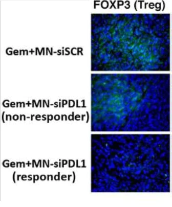 Immunohistochemistry (Formalin/PFA-fixed paraffin-embedded sections) - Anti-FOXP3 antibody (AB75763)