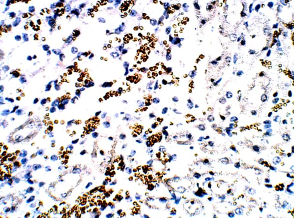 Immunohistochemistry (Formalin/PFA-fixed paraffin-embedded sections) - Anti-FOXP3 antibody (AB75763)