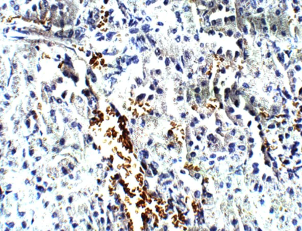 Immunohistochemistry (Formalin/PFA-fixed paraffin-embedded sections) - Anti-FOXP3 antibody (AB75763)
