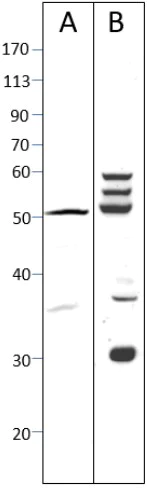 Western blot - Anti-FOXP3 antibody (AB75763)