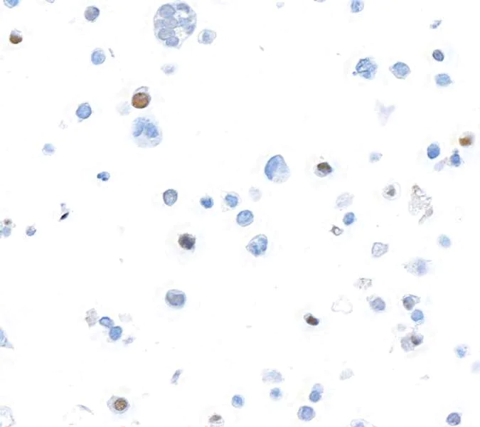 Immunocytochemistry - Anti-FOXP3 antibody [BLR034F] - BSA free (AB243890)