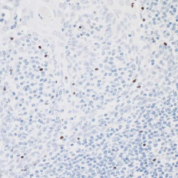 Immunohistochemistry (Formalin/PFA-fixed paraffin-embedded sections) - Anti-FOXP3 antibody [BLR034F] - BSA free (AB243890)