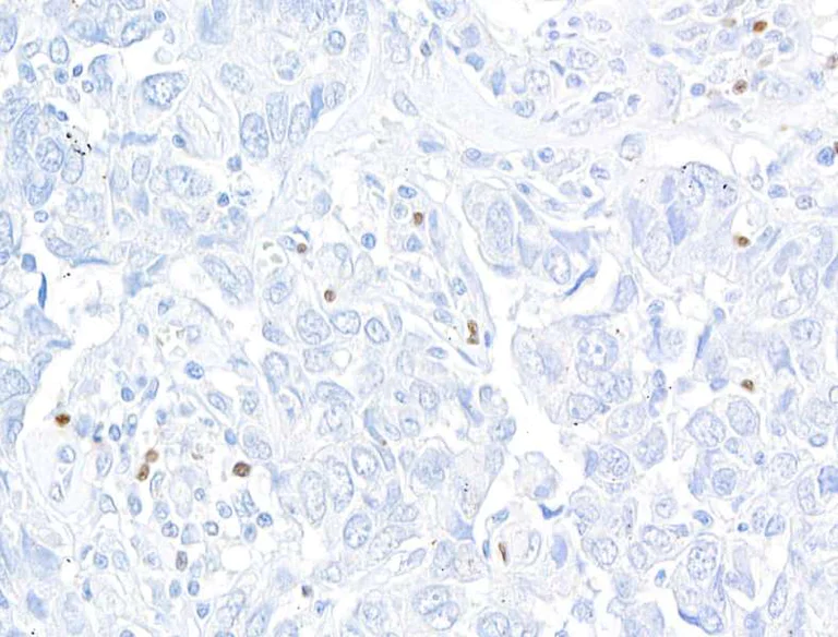 Immunohistochemistry (Formalin/PFA-fixed paraffin-embedded sections) - Anti-FOXP3 antibody [BLR034F] - BSA free (AB243890)