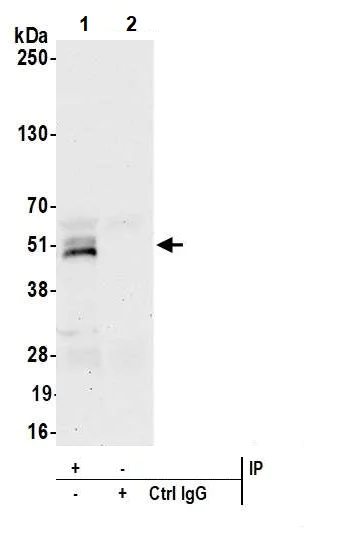 Immunoprecipitation - Anti-FOXP3 antibody [BLR034F] - BSA free (AB243890)