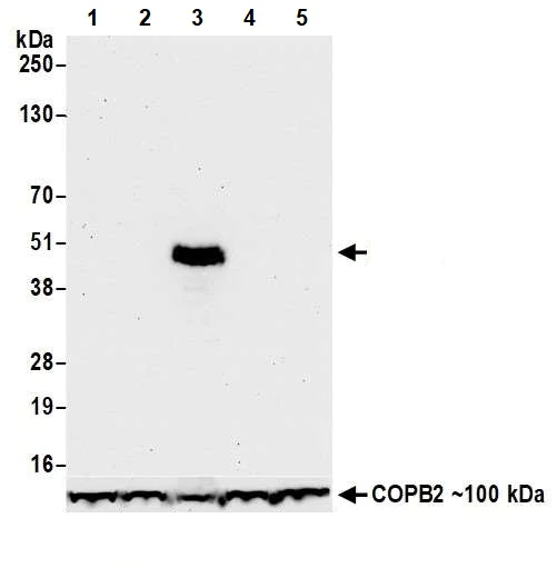 Western blot - Anti-FOXP3 antibody [BLR034F] - BSA free (AB243890)