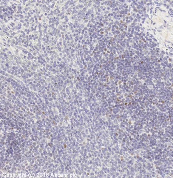 Immunohistochemistry (Formalin/PFA-fixed paraffin-embedded sections) - Anti-FOXP3 antibody [EPR15038-69] (AB191416)