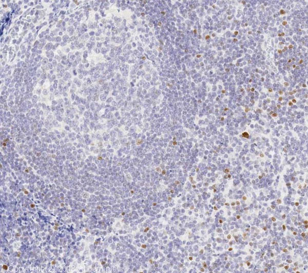 Immunohistochemistry (Formalin/PFA-fixed paraffin-embedded sections) - Anti-FOXP3 antibody [EPR15038-69] (AB191416)