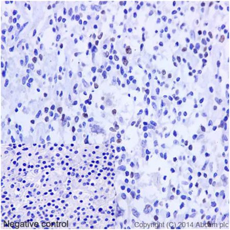 Immunohistochemistry (Formalin/PFA-fixed paraffin-embedded sections) - Anti-FOXP3 antibody [EPR15038-69] (AB191416)