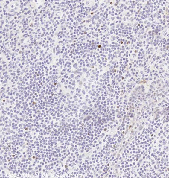 Immunohistochemistry (Frozen sections) - Anti-FOXP3 antibody [EPR15038-69] (AB191416)