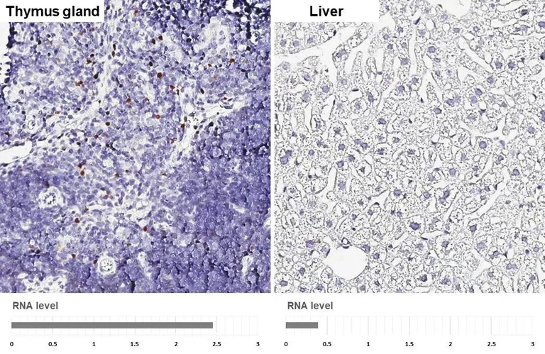 Immunohistochemistry (Formalin/PFA-fixed paraffin-embedded sections) - Anti-FOXP3 antibody [HL4717] - BSA and Azide free (AB327564)