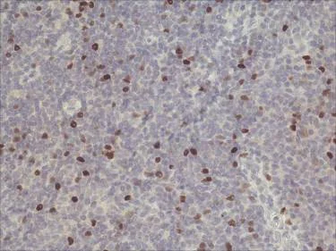 Immunohistochemistry (Formalin/PFA-fixed paraffin-embedded sections) - Anti-FOXP3 antibody [mAbcam 22510] (AB22510)