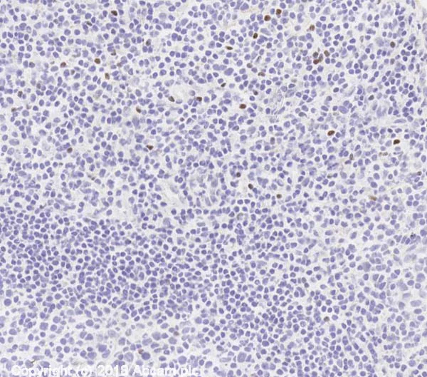 Immunohistochemistry (Frozen sections) - Anti-FOXP3 antibody [mAbcam 22510] (AB22510)
