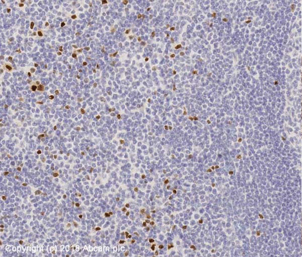 Immunohistochemistry (Formalin/PFA-fixed paraffin-embedded sections) - Anti-FOXP3 antibody [mAbcam 22510] - BSA and Azide free (AB188638), expandable thumbnail