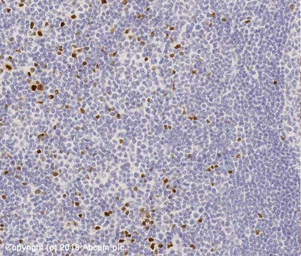 Immunohistochemistry (Formalin/PFA-fixed paraffin-embedded sections) - Anti-FOXP3 antibody [mAbcam 22510] - BSA and Azide free (AB188638)