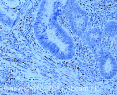 Immunohistochemistry (Formalin/PFA-fixed paraffin-embedded sections) - Anti-FOXP3 antibody [mAbcam 22510] - BSA and Azide free (AB188638), expandable thumbnail