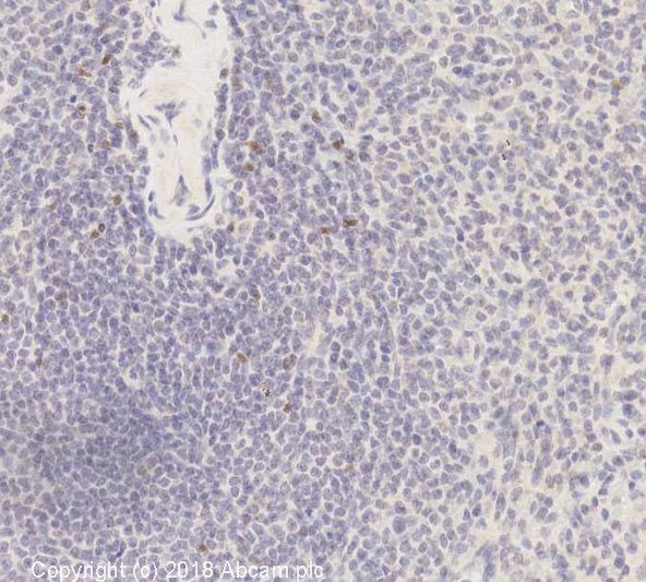 Immunohistochemistry (Formalin/PFA-fixed paraffin-embedded sections) - Anti-FOXP3 antibody [mAbcam 22510] - BSA and Azide free (AB188638), expandable thumbnail