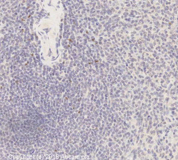 Immunohistochemistry (Formalin/PFA-fixed paraffin-embedded sections) - Anti-FOXP3 antibody [mAbcam 22510] - BSA and Azide free (AB188638)