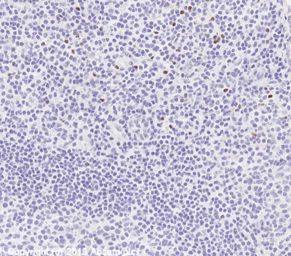 Immunohistochemistry (Frozen sections) - Anti-FOXP3 antibody [mAbcam 22510] - BSA and Azide free (AB188638), expandable thumbnail