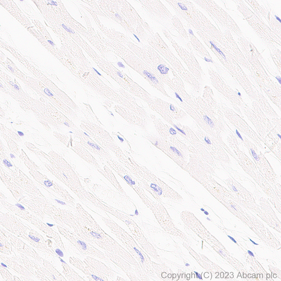 Immunohistochemistry (Formalin/PFA-fixed paraffin-embedded sections) - Anti-FOXP3 antibody [mAbcam 450] - Mouse IgG2a (AB309108), expandable thumbnail