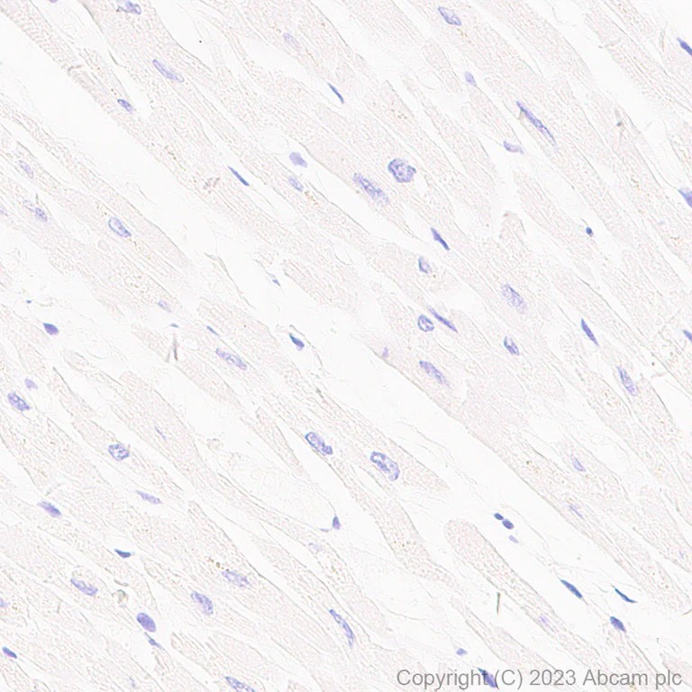 Immunohistochemistry (Formalin/PFA-fixed paraffin-embedded sections) - Anti-FOXP3 antibody [mAbcam 450] - Mouse IgG2a (AB309108)