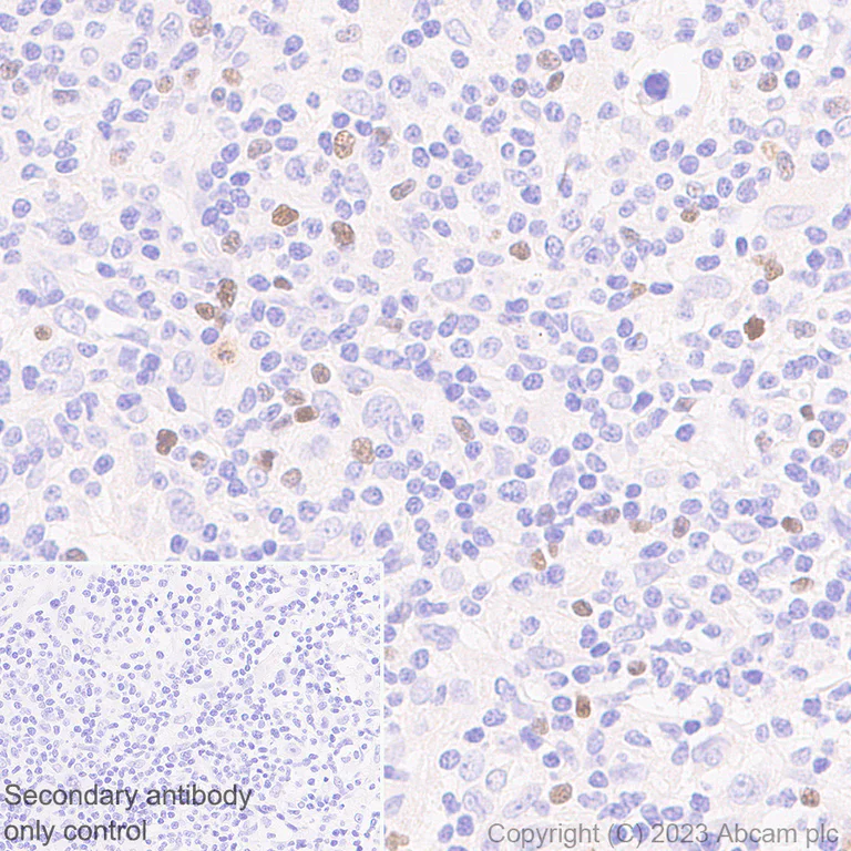 Immunohistochemistry (Formalin/PFA-fixed paraffin-embedded sections) - Anti-FOXP3 antibody [mAbcam 450] - Mouse IgG2a (AB309108)