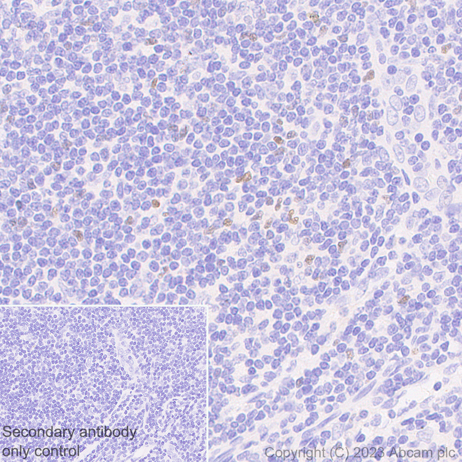 Immunohistochemistry (Formalin/PFA-fixed paraffin-embedded sections) - Anti-FOXP3 antibody [mAbcam 450] - Mouse IgG2a (AB309108), expandable thumbnail