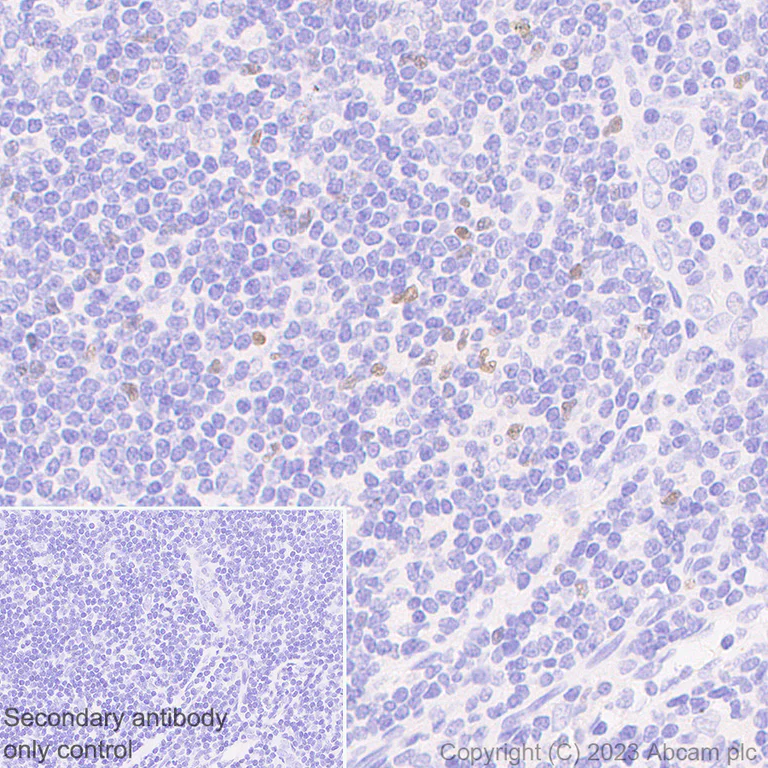 Immunohistochemistry (Formalin/PFA-fixed paraffin-embedded sections) - Anti-FOXP3 antibody [mAbcam 450] - Mouse IgG2a (AB309108)
