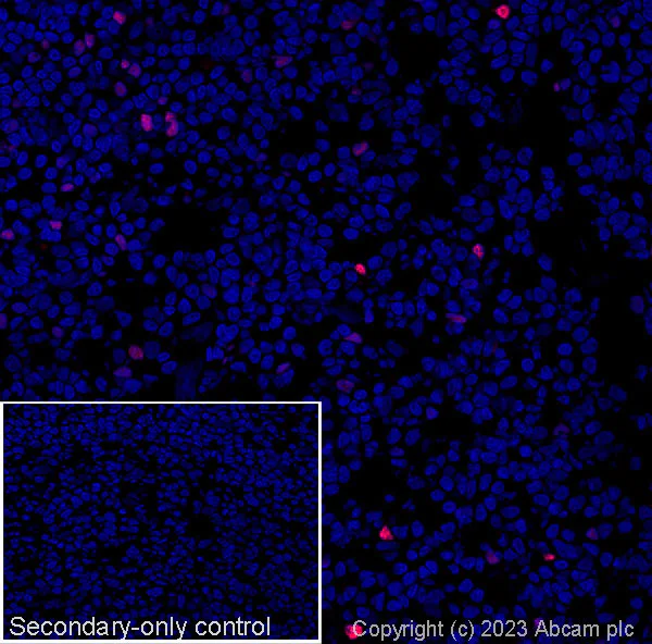 Immunohistochemistry (Frozen sections) - Anti-FOXP3 antibody [mAbcam 450] - Mouse IgG2a (AB309108)