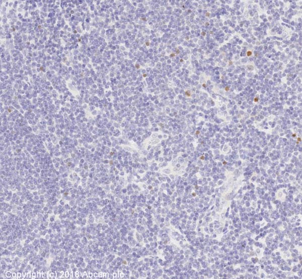 Immunohistochemistry (Formalin/PFA-fixed paraffin-embedded sections) - Anti-FOXP3 antibody [mAbcam 450] - Mouse IgG3 (AB450), expandable thumbnail