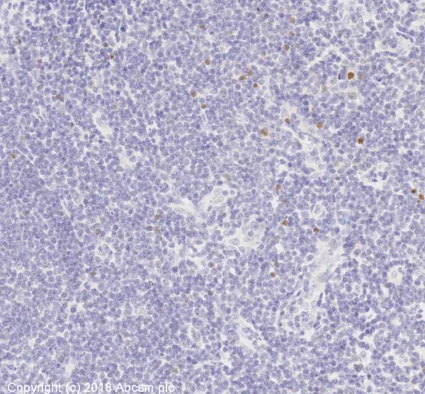Immunohistochemistry (Formalin/PFA-fixed paraffin-embedded sections) - Anti-FOXP3 antibody [mAbcam 450] - Mouse IgG3 (AB450)