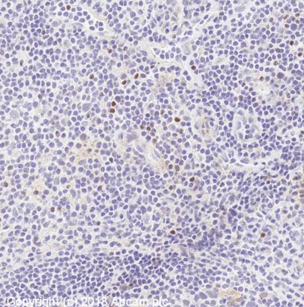 Immunohistochemistry (Frozen sections) - Anti-FOXP3 antibody [mAbcam 450] - Mouse IgG3 (AB450), expandable thumbnail