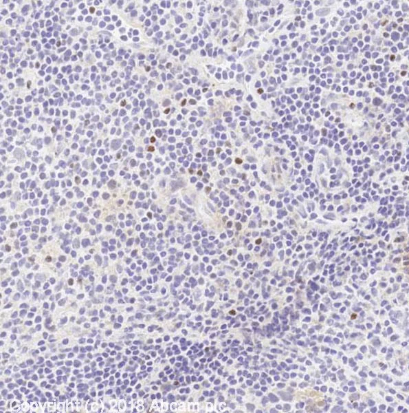 Immunohistochemistry (Frozen sections) - Anti-FOXP3 antibody [mAbcam 450] - Mouse IgG3 (AB450)