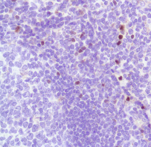 Immunohistochemistry (Formalin/PFA-fixed paraffin-embedded sections) - FoxP3 Antibody Panel (EPR15038-69, EPR22102-37, SP97, BLR034F, 236A/E7) (AB252201)