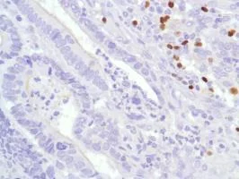 Immunohistochemistry (Formalin/PFA-fixed paraffin-embedded sections) - Anti-FOXP3 antibody [SP97] (AB99963)