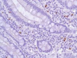 Immunohistochemistry (Formalin/PFA-fixed paraffin-embedded sections) - Anti-FOXP3 antibody [SP97] (AB99963)