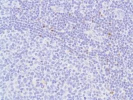 Immunohistochemistry (Formalin/PFA-fixed paraffin-embedded sections) - Anti-FOXP3 antibody [SP97] (AB99963)