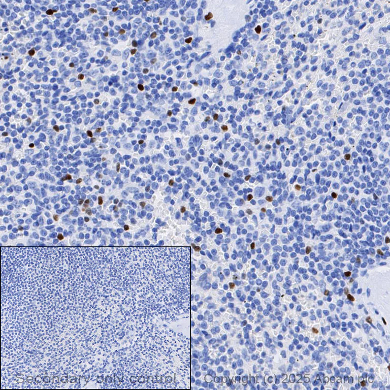 Immunohistochemistry (Formalin/PFA-fixed paraffin-embedded sections) - Anti-FOXP3 antibody [SP97] (AB99963)