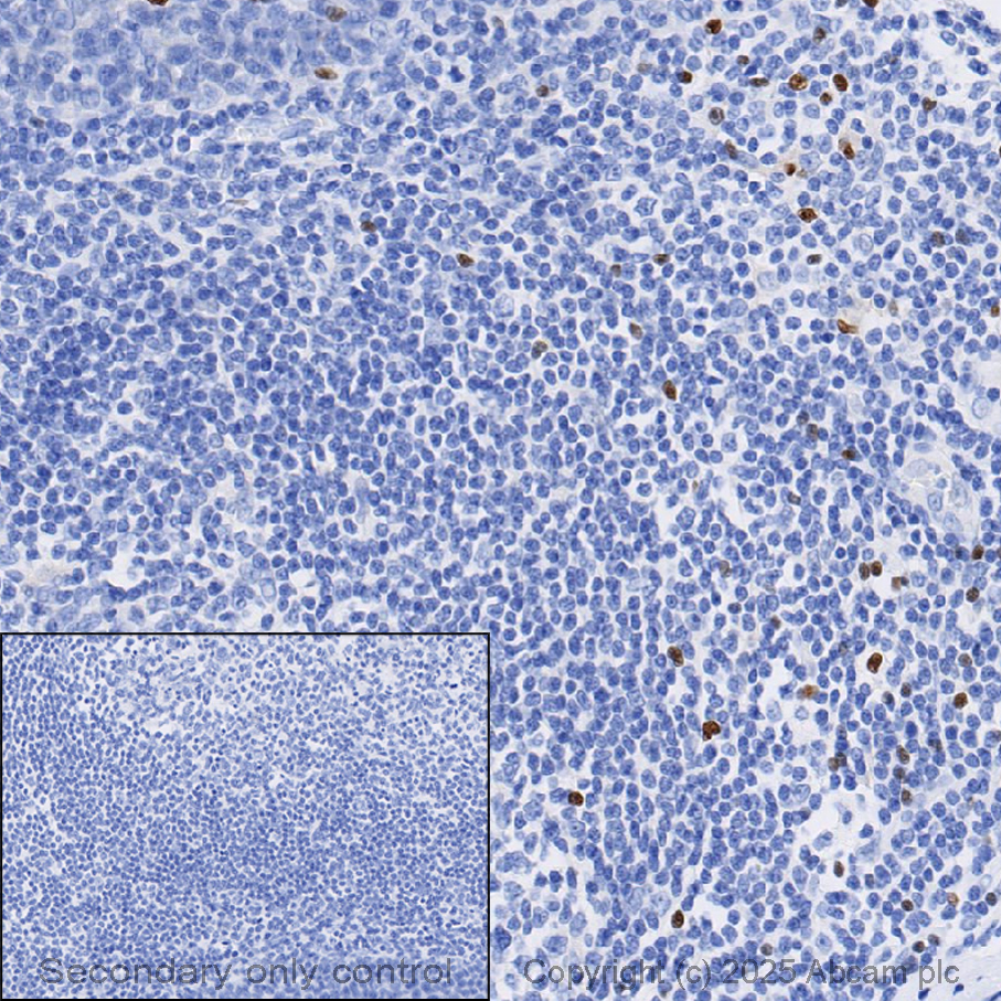 Anti-FOXP3 抗体 [SP97] (ab99963) | Abcam