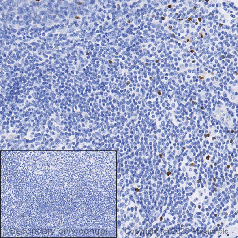 Immunohistochemistry (Formalin/PFA-fixed paraffin-embedded sections) - Anti-FOXP3 antibody [SP97] (AB99963)