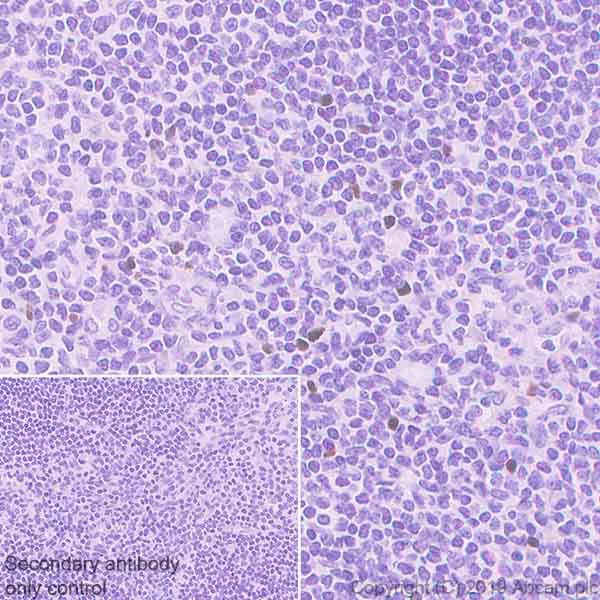Immunohistochemistry (Formalin/PFA-fixed paraffin-embedded sections) - Anti-FOXP3 antibody [SP97] (AB99963)