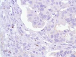 Immunohistochemistry (Formalin/PFA-fixed paraffin-embedded sections) - Anti-FOXP3 antibody [SP97] (AB99963)