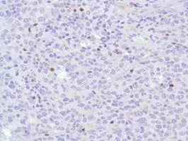 Immunohistochemistry (Formalin/PFA-fixed paraffin-embedded sections) - Anti-FOXP3 antibody [SP97] - BSA and Azide free (AB238809)