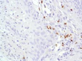 Immunohistochemistry (Formalin/PFA-fixed paraffin-embedded sections) - Anti-FOXP3 antibody [SP97] - BSA and Azide free (AB238809)