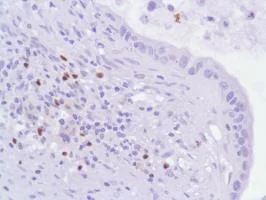 Immunohistochemistry (Formalin/PFA-fixed paraffin-embedded sections) - Anti-FOXP3 antibody [SP97] - BSA and Azide free (AB238809)