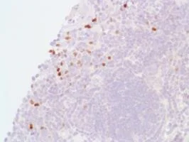 Immunohistochemistry (Formalin/PFA-fixed paraffin-embedded sections) - Anti-FOXP3 antibody [SP97] - BSA and Azide free (AB238809)