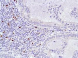 Immunohistochemistry (Formalin/PFA-fixed paraffin-embedded sections) - Anti-FOXP3 antibody [SP97] - BSA and Azide free (AB238809)